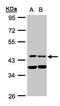 Pyruvate Dehydrogenase Kinase 1 antibody, PA5-28342, Invitrogen Antibodies, Western Blot image 