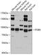 Integrin Subunit Beta 5 antibody, GTX54374, GeneTex, Western Blot image 
