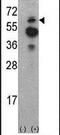 ACK1 antibody, PA5-14764, Invitrogen Antibodies, Western Blot image 