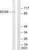 SRY-Box 6 antibody, LS-C118875, Lifespan Biosciences, Western Blot image 