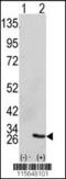 Growth Factor Receptor Bound Protein 2 antibody, 62-217, ProSci, Western Blot image 