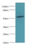 Thyroid Hormone Receptor Beta antibody, MBS7002957, MyBioSource, Western Blot image 