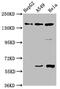NLR Family Apoptosis Inhibitory Protein antibody, CSB-PA615662LA01HU, Cusabio, Western Blot image 