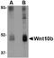 Wnt Family Member 10B antibody, NBP1-77325, Novus Biologicals, Western Blot image 