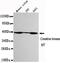 Creatine Kinase, Mitochondrial 1B antibody, GTX49207, GeneTex, Western Blot image 