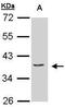 Eukaryotic Translation Initiation Factor 3 Subunit M antibody, PA5-28447, Invitrogen Antibodies, Western Blot image 