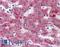 C1 esterase inhibitor antibody, LS-B6012, Lifespan Biosciences, Immunohistochemistry frozen image 