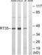 Mitochondrial Ribosomal Protein S35 antibody, LS-C119614, Lifespan Biosciences, Western Blot image 