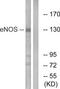 Nitric Oxide Synthase 3 antibody, TA314272, Origene, Western Blot image 