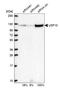 Ubiquitin Specific Peptidase 10 antibody, NBP1-83029, Novus Biologicals, Western Blot image 