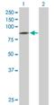 Sodium Channel Epithelial 1 Delta Subunit antibody, H00006339-D01P, Novus Biologicals, Western Blot image 