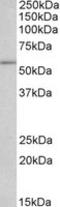 RNA 2',3'-Cyclic Phosphate And 5'-OH Ligase antibody, LS-C139807, Lifespan Biosciences, Western Blot image 