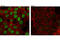Checkpoint Kinase 2 antibody, 6334T, Cell Signaling Technology, Immunocytochemistry image 