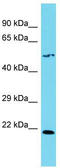 Solute Carrier Family 35 Member F4 antibody, TA334862, Origene, Western Blot image 