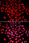 Calcium/Calmodulin Dependent Protein Kinase IV antibody, STJ27257, St John