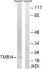 Transmembrane BAX Inhibitor Motif Containing 4 antibody, GTX87431, GeneTex, Western Blot image 