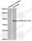 Myristoylated Alanine Rich Protein Kinase C Substrate antibody, AP0402, ABclonal Technology, Western Blot image 