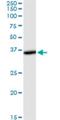 THUMP Domain Containing 1 antibody, H00055623-M01, Novus Biologicals, Western Blot image 