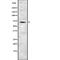 Guanylate cyclase soluble subunit beta-2 antibody, abx215780, Abbexa, Western Blot image 