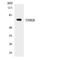 Thyroid Hormone Receptor Beta antibody, LS-C200784, Lifespan Biosciences, Western Blot image 