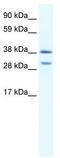 Homeobox protein Nkx-2.3 antibody, TA331644, Origene, Western Blot image 