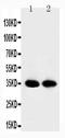 Apurinic/Apyrimidinic Endodeoxyribonuclease 1 antibody, PA1494, Boster Biological Technology, Western Blot image 