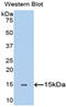 Semaphorin 5B antibody, LS-C297521, Lifespan Biosciences, Western Blot image 