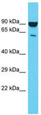 N-Myristoyltransferase 2 antibody, TA346732, Origene, Western Blot image 