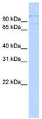 RNA Binding Motif Protein 12 antibody, TA345942, Origene, Western Blot image 