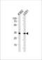 TATA-Box Binding Protein antibody, MBS9202342, MyBioSource, Western Blot image 