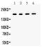 Thrombospondin 1 antibody, PB9450, Boster Biological Technology, Western Blot image 