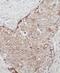 ST6 N-Acetylgalactosaminide Alpha-2,6-Sialyltransferase 5 antibody, FNab08271, FineTest, Immunohistochemistry frozen image 