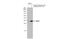 Snail Family Transcriptional Repressor 1 antibody, GTX100754, GeneTex, Western Blot image 