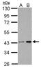 Casein Kinase 2 Alpha 1 antibody, NBP2-15909, Novus Biologicals, Western Blot image 