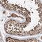 Inositol Polyphosphate-4-Phosphatase Type II B antibody, NBP1-86272, Novus Biologicals, Immunohistochemistry paraffin image 