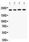 Calcium Voltage-Gated Channel Subunit Alpha1 F antibody, PB9530, Boster Biological Technology, Western Blot image 