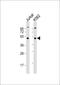 Makorin Ring Finger Protein 2 antibody, M10562, Boster Biological Technology, Western Blot image 