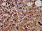 Cyclin Y antibody, CSB-PA847689LA01HU, Cusabio, Immunohistochemistry paraffin image 