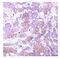 ALK Receptor Tyrosine Kinase antibody, GTX79146, GeneTex, Immunohistochemistry paraffin image 