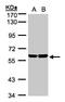 Protein TBRG4 antibody, LS-C185877, Lifespan Biosciences, Western Blot image 