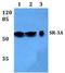 5-Hydroxytryptamine Receptor 3A antibody, GTX66674, GeneTex, Western Blot image 