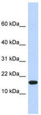 Egl-9 Family Hypoxia Inducible Factor 2 antibody, TA337938, Origene, Western Blot image 