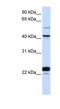Even-Skipped Homeobox 1 antibody, NBP1-79701, Novus Biologicals, Western Blot image 