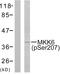 Mitogen-Activated Protein Kinase Kinase 6 antibody, LS-C199262, Lifespan Biosciences, Western Blot image 