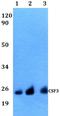 Colony Stimulating Factor 3 antibody, A02280, Boster Biological Technology, Western Blot image 