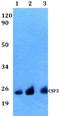 G-CSF antibody, A02280, Boster Biological Technology, Western Blot image 