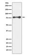 Protein Kinase C Delta antibody, M00822, Boster Biological Technology, Western Blot image 