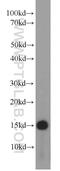 Small Nuclear Ribonucleoprotein 13 antibody, 15802-1-AP, Proteintech Group, Western Blot image 