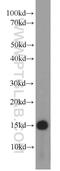 NHP2-like protein 1 antibody, 15802-1-AP, Proteintech Group, Western Blot image 