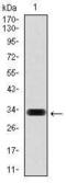 Hyaluronan Synthase 3 antibody, MA5-17088, Invitrogen Antibodies, Western Blot image 